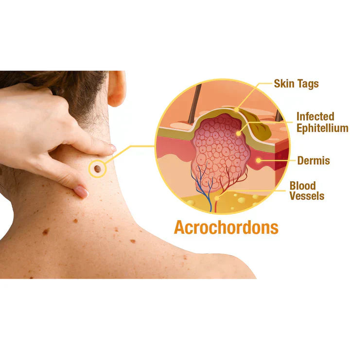 Last Day Of Discount š„ TagRecede Bee Venom Treatment Spray